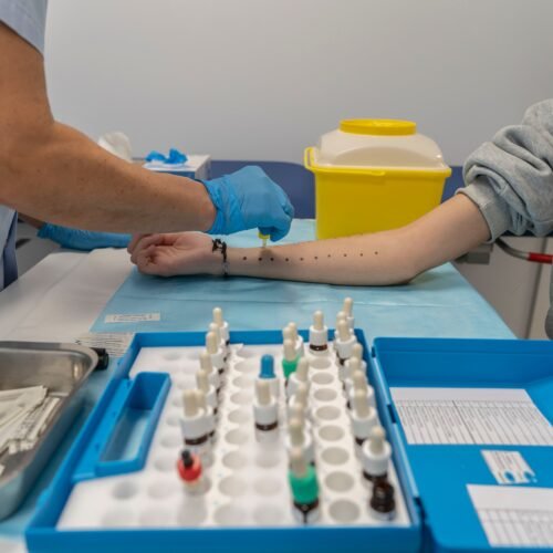 El cambio climático empeora las alergias, aumenta las olas de calor y empobrece la dieta en Europa