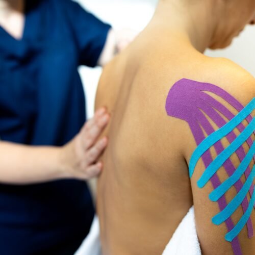 Mucho uso, poca ciencia: el ‘kinesiotaping’, las tiras de colores que alivian el dolor, no logra pruebas de su utilidad